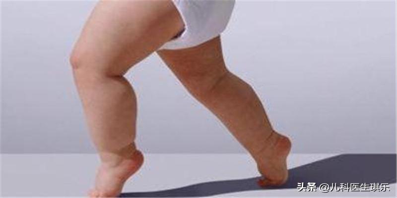 2岁孩子走路内八字怎么办(宝宝在学走路的时候出现内八字属不属于正常)