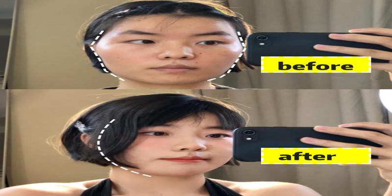 这种脸型太影响颜值,怎么解决?