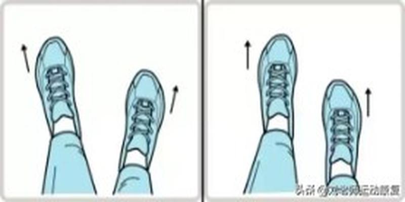 30岁外八字腿怎么矫正(五步矫正“外八字”足)