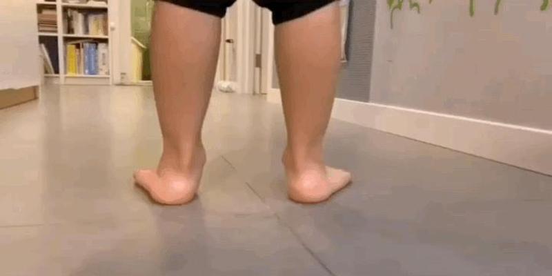 2岁宝宝轻微内八字正常吗(孩子走路“内八”)