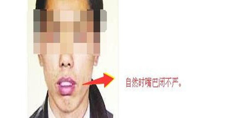 这几种男人面相得注意，不能嫁啊，建议远离！