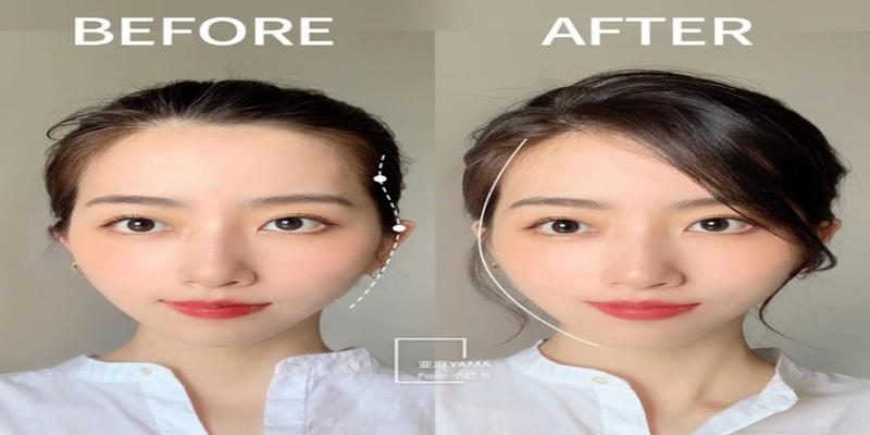 这种脸型太影响颜值,怎么解决?