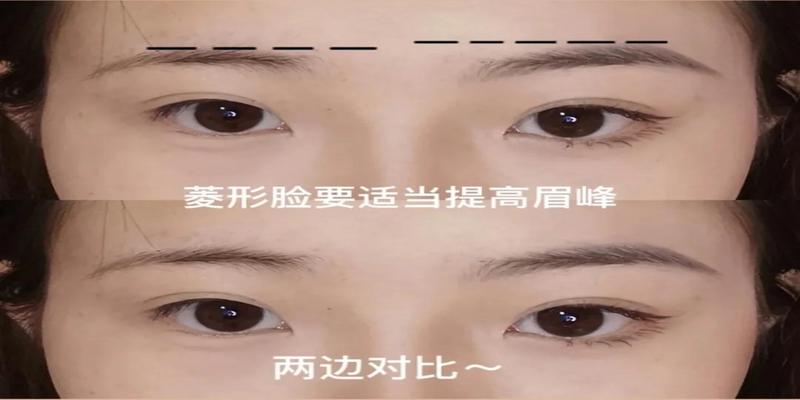 这种脸型太影响颜值,怎么解决?