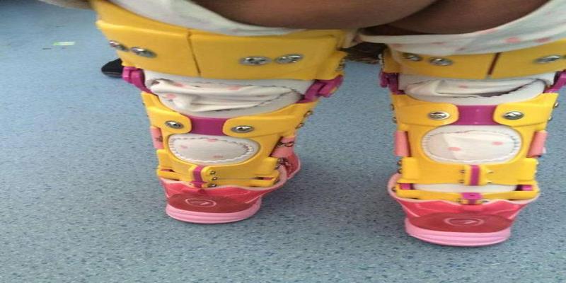 儿童膝内翻与膝外翻需要矫正么？