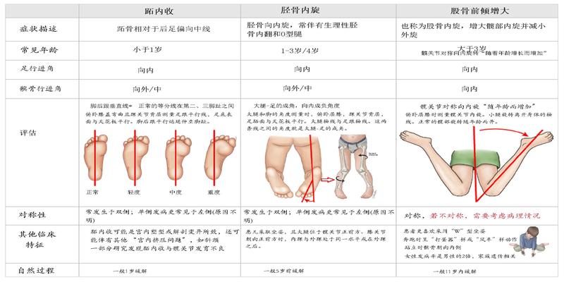 小孩走路内八字，需要担心么？