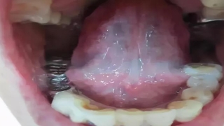 耳鸣时间测吉凶周易(观舌象辨证型)