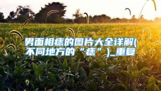 男面相痣的图片大全详解(不同地方的“痣”)_重复