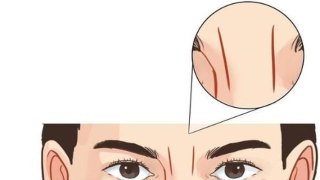 看印堂面相算命(4种印堂的纹路)