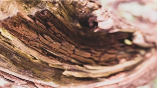 花钱流水的体相特征(印堂有倒三角)