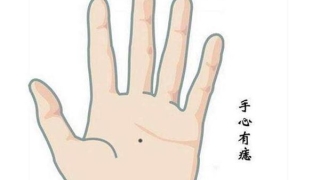 解析“痣”在掌上(掌心的爱情)