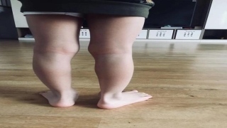 2岁宝宝内八字脚如何矫正(6岁孩子看起来内八与膝外翻怎么办呢)_重复