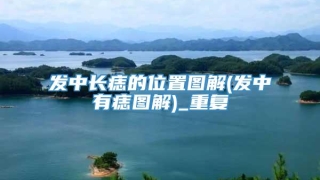 发中长痣的位置图解(发中有痣图解)_重复