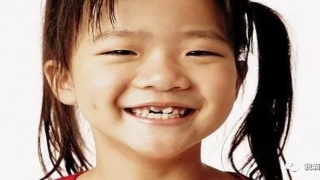 大门牙八字形(换牙期宝贝为什么“丑丑”的)