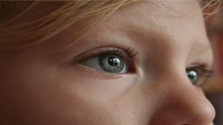 面相额头有疤痕对运势有什么影响?(额头命宫有疤痕的面相)