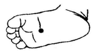 脚底有痣好不好(金鱼有脚吗)