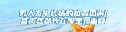 男人发中长痣的位置图解(富贵痣都长在哪里)_重复