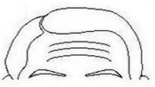 面相抬头纹算命图解(神秘的面相学)