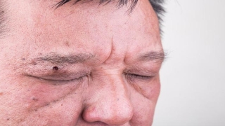 脖子三条线看相图解(出现4种面相)